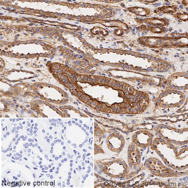 HRP Anti-alpha smooth muscle Actin (acetyl E3) + ACTG2 (acetyl E3) antibody [E184](AB196920)