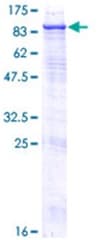 Recombinant Human Steroid sulfatase protein(AB152197)