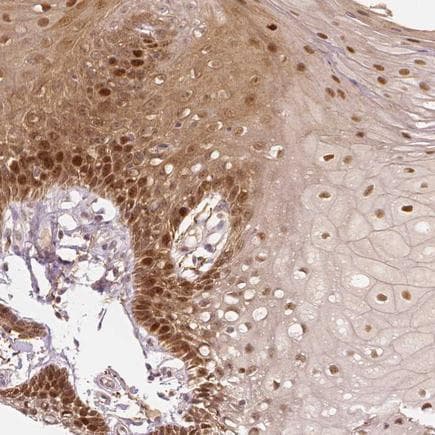 Anti-WHSC1/NSD2 antibody(AB223694)