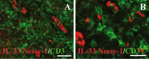 Anti-CD3 epsilon antibody [SP7](AB16669)