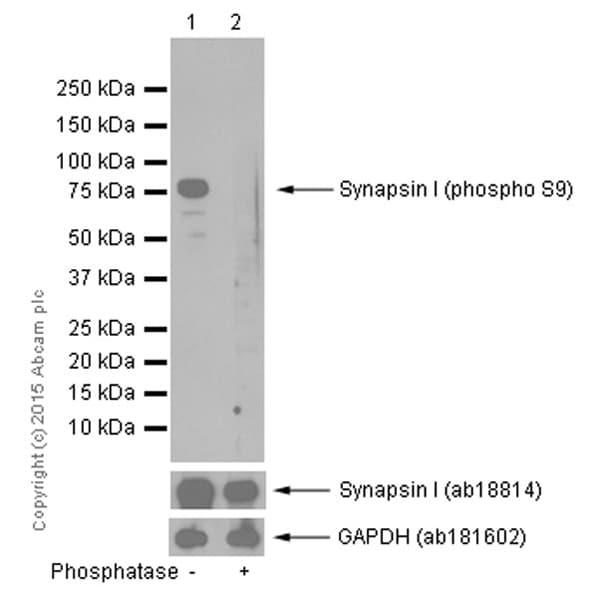 Synapsin I Phospho S9 Antibody Ep2162y Ab76260  Western Blot Img21679