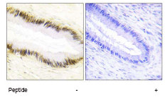 Anti-NR2F6/EAR-2 antibody(ab65012)
