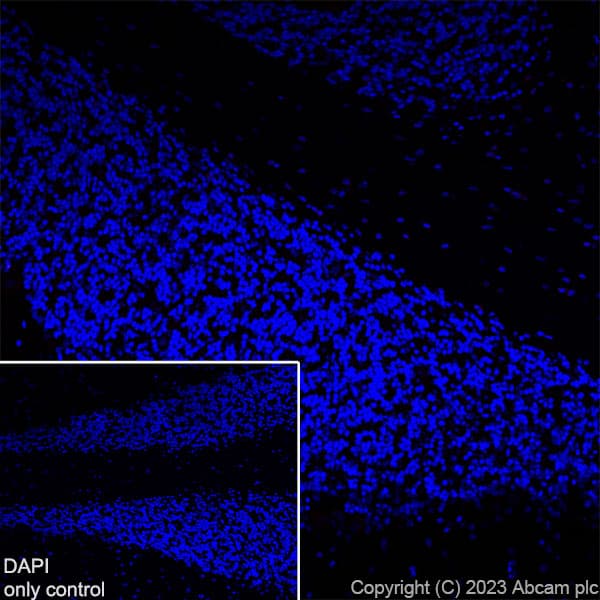 Alexa Fluor® 647 Anti-TBR1 antibody [EPR8138(2)](AB314473)