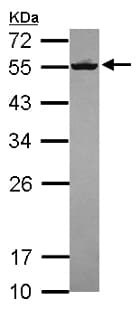 Septin 8 Antibody Ab154112  Western Blot Img148290