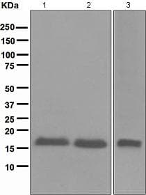 Anti-CDKN2A/p16INK4a antibody [EPR1473] - C-terminal(AB108349)