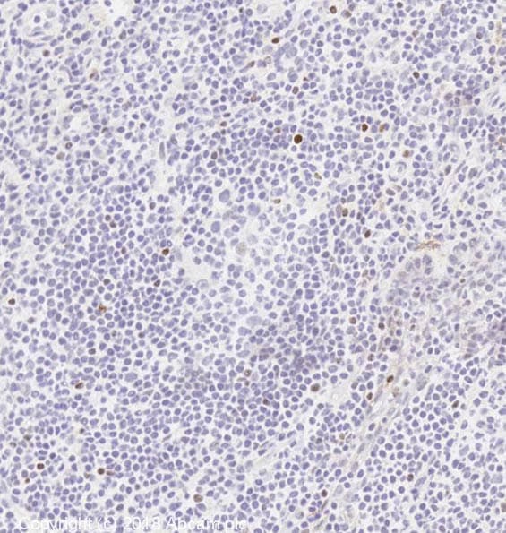 Foxp3 Antibody Epr15038 69 Ab191416  Immunohistochemistry Frozen Sections Img65249