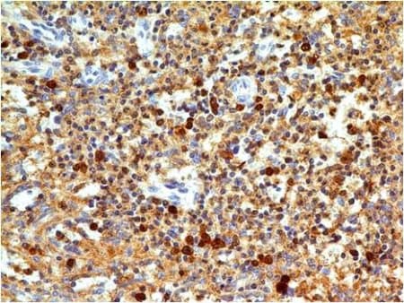 Caspase 3 Antibody Abm1c12 Ab208161  Immunohistochemistry Formalin Pfa Fixed Paraffin Embedded Sections Img35063