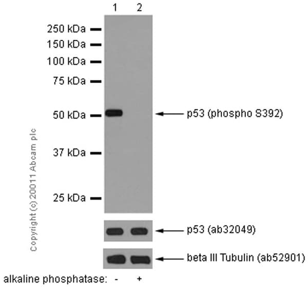 Anti-p53 (phospho S392) antibody [EP155Y] - BSA and Azide free(ab239211)