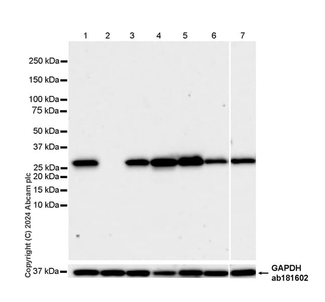 Anti-Slc25a1 antibody [EPR29193-92](AB318201)