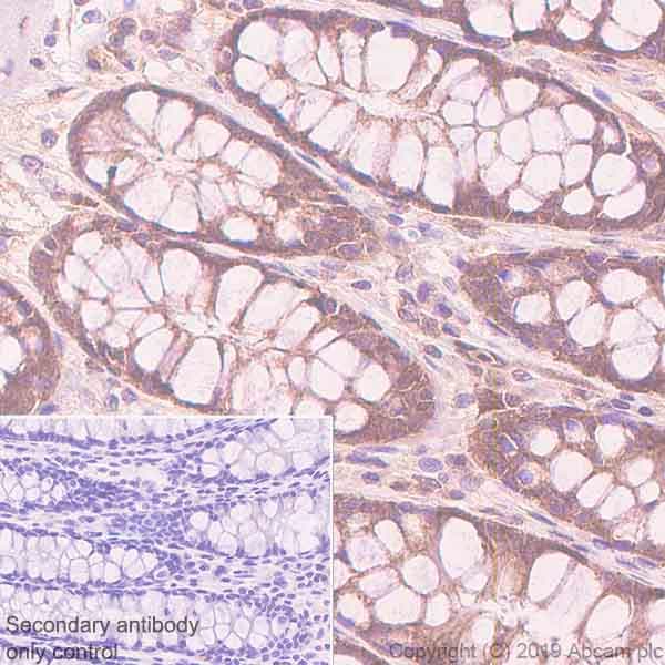 Anti-TFEB antibody [EPR22940-151](AB270604)