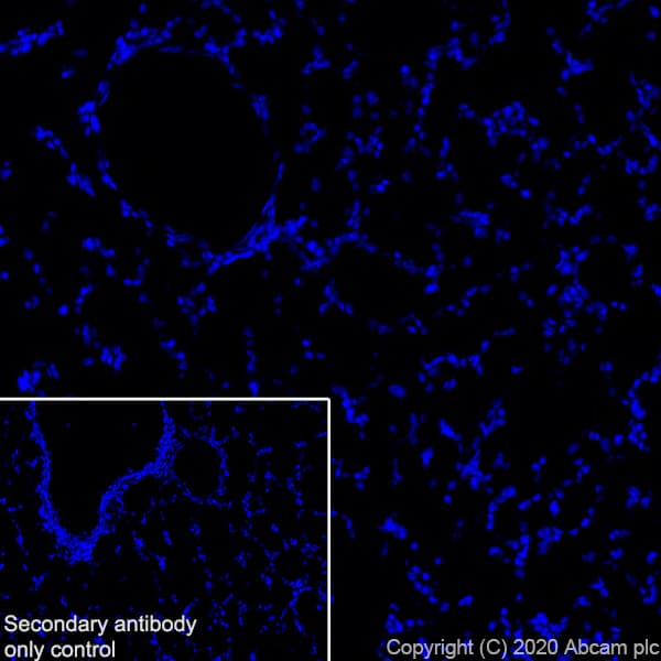 Anti-Synapsin I antibody [EPR23531-50] - Synaptic Marker(AB254349)