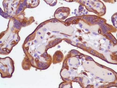 Egfr Antibody Sp84 Bsa And Azide Free Ab238803  Immunohistochemistry Formalin Pfa Fixed Paraffin Embedded Sections Img136646