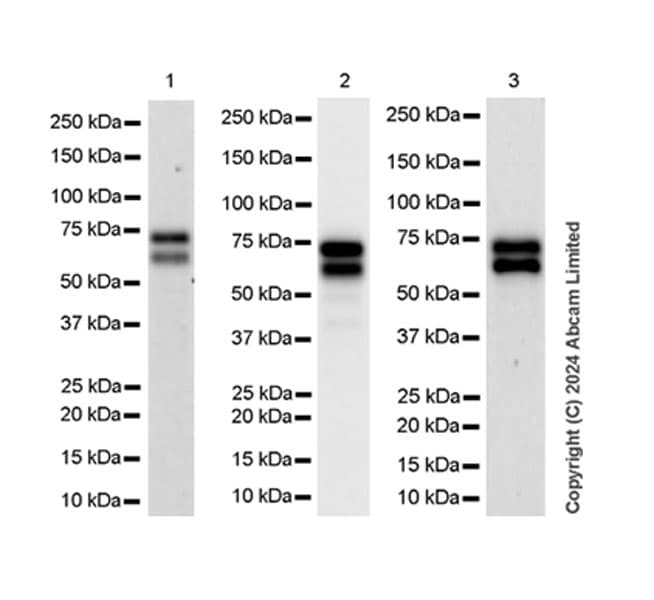 Anti-TOX antibody [EPR28108-10](ab322259)