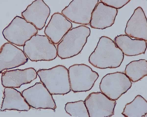 Anti-alpha Sarcoglycan antibody [EPR14773](AB189254)