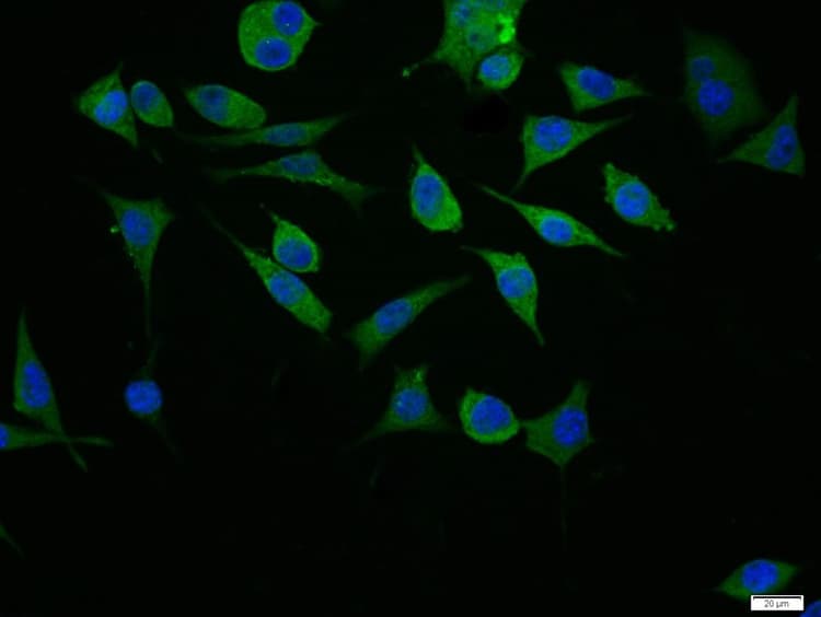 Anti-P Glycoprotein antibody - N-terminal(AB202976)