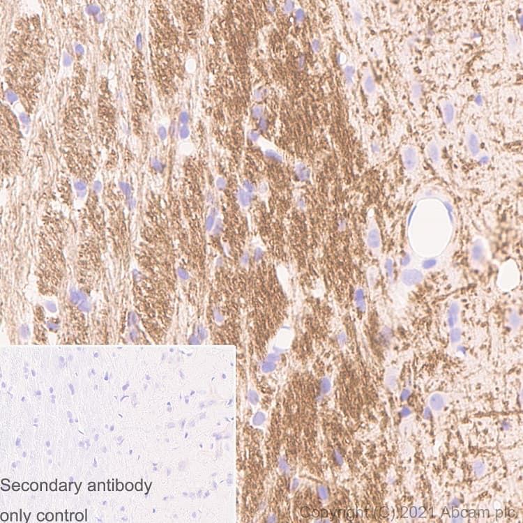 Myelin Plp Antibody Plpc 1 Ab9311  Immunohistochemistry Formalin Pfa Fixed Paraffin Embedded Sections Img165202