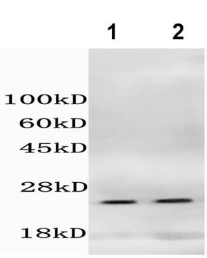 Histone H14 Phospho T18 Antibody Ab203624  Western Blot Img33977