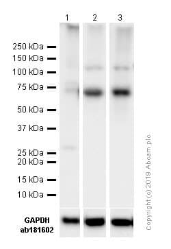 Anti-NF-kB p65 antibody [E379](AB32536)