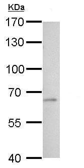 Anti-Tissue Plasminogen Activator antibody(AB227069)