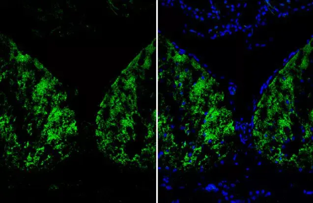 Anti-Liver Arginase antibody(AB96183)