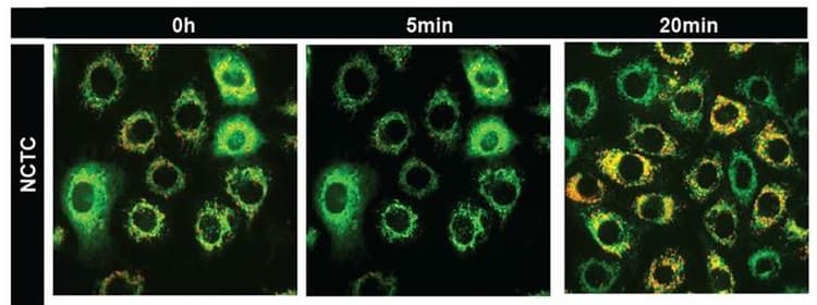 JC-1 - Mitochondrial Membrane Potential Assay Kit(AB113850)