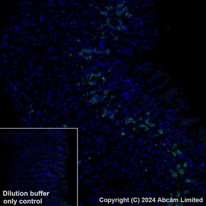 Anti-Ki67 antibody [B56](AB279653)