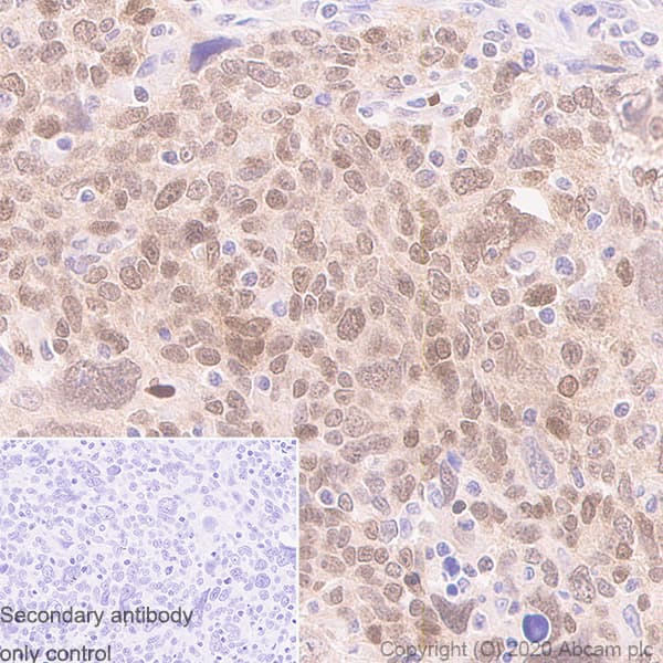 Anti-MGMT antibody [MT3.1](AB39253)