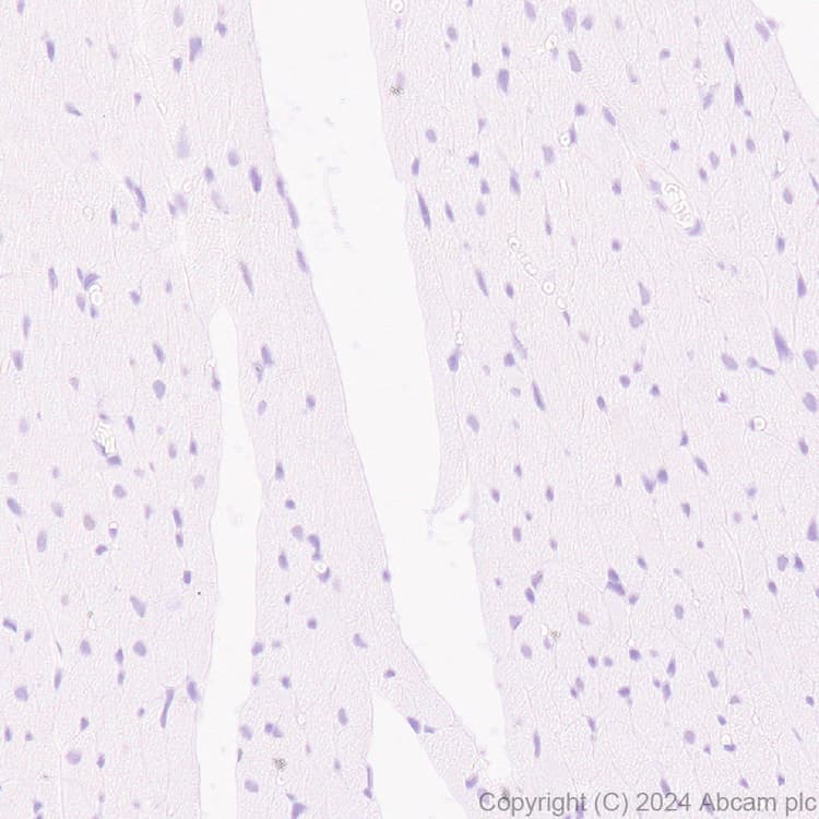 Anti-BRN3A + BRN3B + BRN3C antibody [EPR26313-54](AB317492)