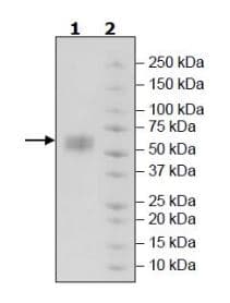 Recombinant Human NKG2D protein (Tagged) (Biotin)(ab271632)