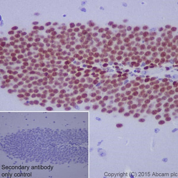 Anti-PROX1 antibody [EPR19273](AB199359)