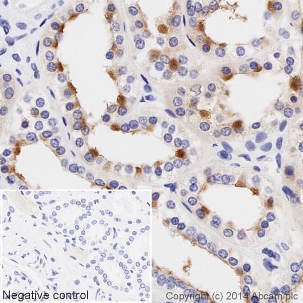HRP Anti-MUC1 antibody [EPR1023](AB195936)