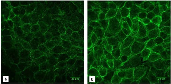 Anti-Integrin beta 1 antibody [P5D2](ab24693)