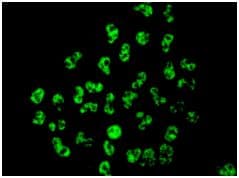 Anti-Tat-SF1 antibody [EPR9104(B)] - BSA and Azide free(AB248932)
