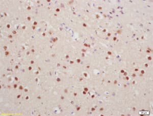 Histone H14 Phospho T18 Antibody Ab203624  Immunohistochemistry Formalin Pfa Fixed Paraffin Embedded Sections Img107749