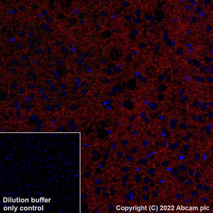 Alexa Fluor® 555 Anti-Tyrosine Hydroxylase antibody [EP1532Y] - Neuronal Marker(AB305365)