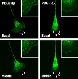 Anti-PDGFR alpha + PDGFR beta antibody [Y92] - C-terminal(AB32570)