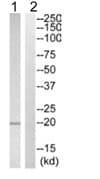 Anti-TIPE2 antibody(AB110389)