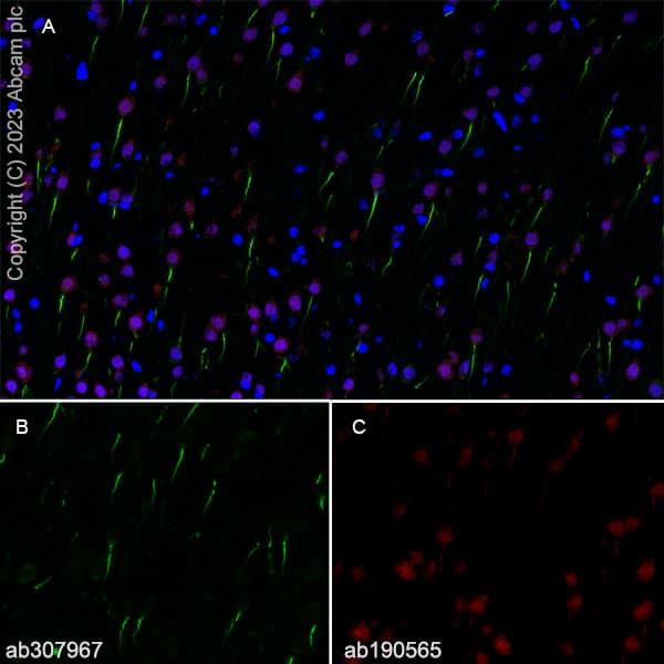 Alexa Fluor® 647 Anti-NeuN antibody [EPR12763] - Neuronal Marker(AB190565)