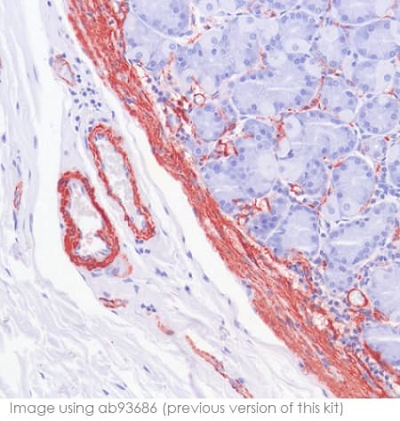Mouse and Rabbit Specific HRP/AEC IHC Detection Kit - Micro-polymer(AB236467)