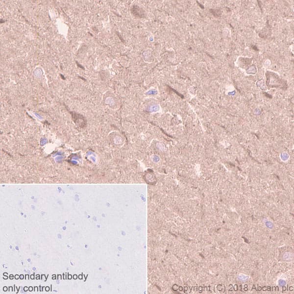 Creatine Kinase B Type Antibody Epr3926 Ab108388  Immunohistochemistry Formalin Pfa Fixed Paraffin Embedded Sections Img104145
