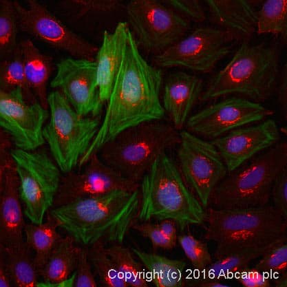 Anti-TAGLN/Transgelin antibody(AB14106)