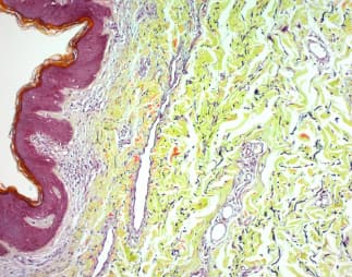 Movat Pentachrome Stain Kit (Modified Russell-Movat)(AB245884)