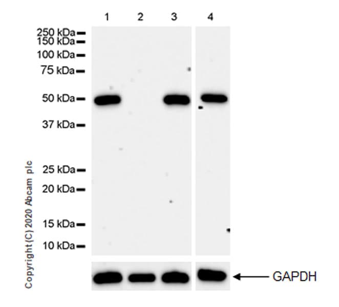 Set7 Antibody Epr23775 142 Ab274416  Western Blot Img91064