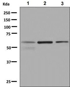 Lgi1 Ept Antibody Epr9084 Ab137045  Western Blot Img106885