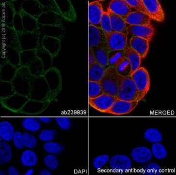 Anti-pan Cadherin antibody [EPR1792Y] - Intercellular Junction Marker(AB51034)