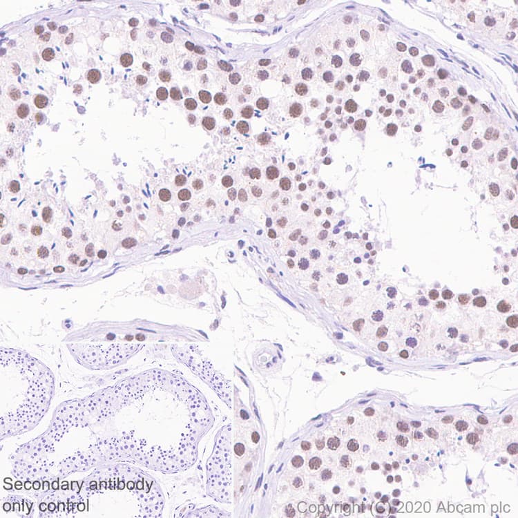 Anti-YTHDC1 antibody [EPR21821-213](AB259990)