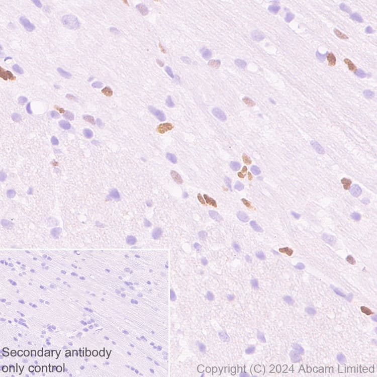 Anti-MASH1/Achaete-scute homolog 1 antibody [EPR19840](AB211327)