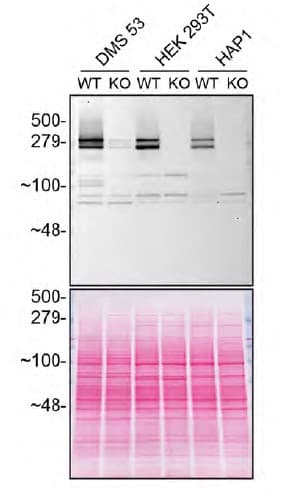 Anti-Huntingtin antibody [EP867Y](AB45169)