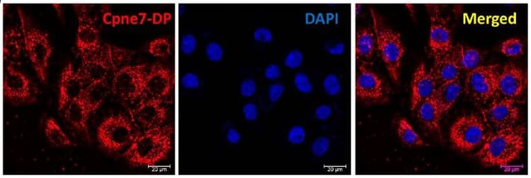 Cy5® Conjugation Kit (Fast) - Lightning-Link®(AB188288)