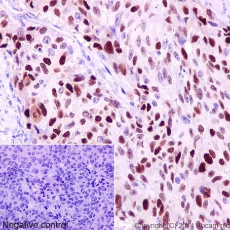 Anti-Cyclin D1 antibody [EPR2241] - C-terminal(AB134175)